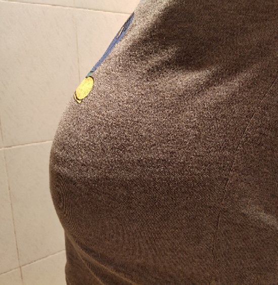 给大家报喜来啦，2019年12.16金贝供卵中心剖腹一个男宝宝，出生6斤5两！